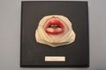 Moulage, Cheilitis (Lippen), 17x17 cm