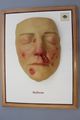 Moulage, Malleus (Gesicht), 34x26 cm