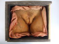 Moulage, Gynakologie (Vulva)